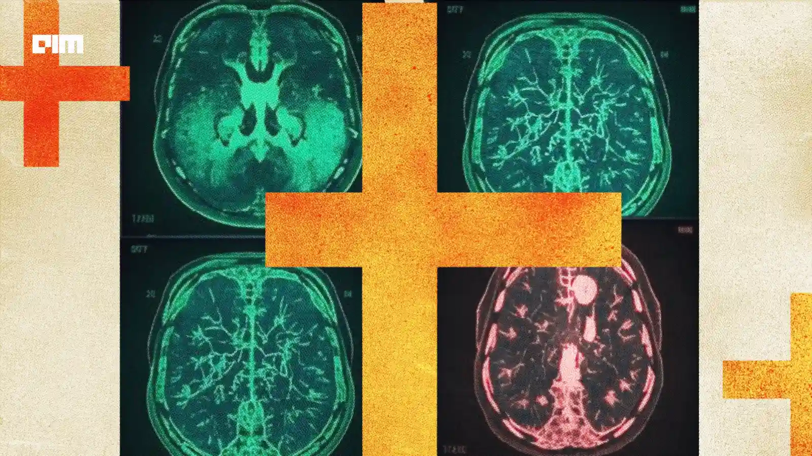 Providence St. Joseph Hospital Lets AI Read Mammograms