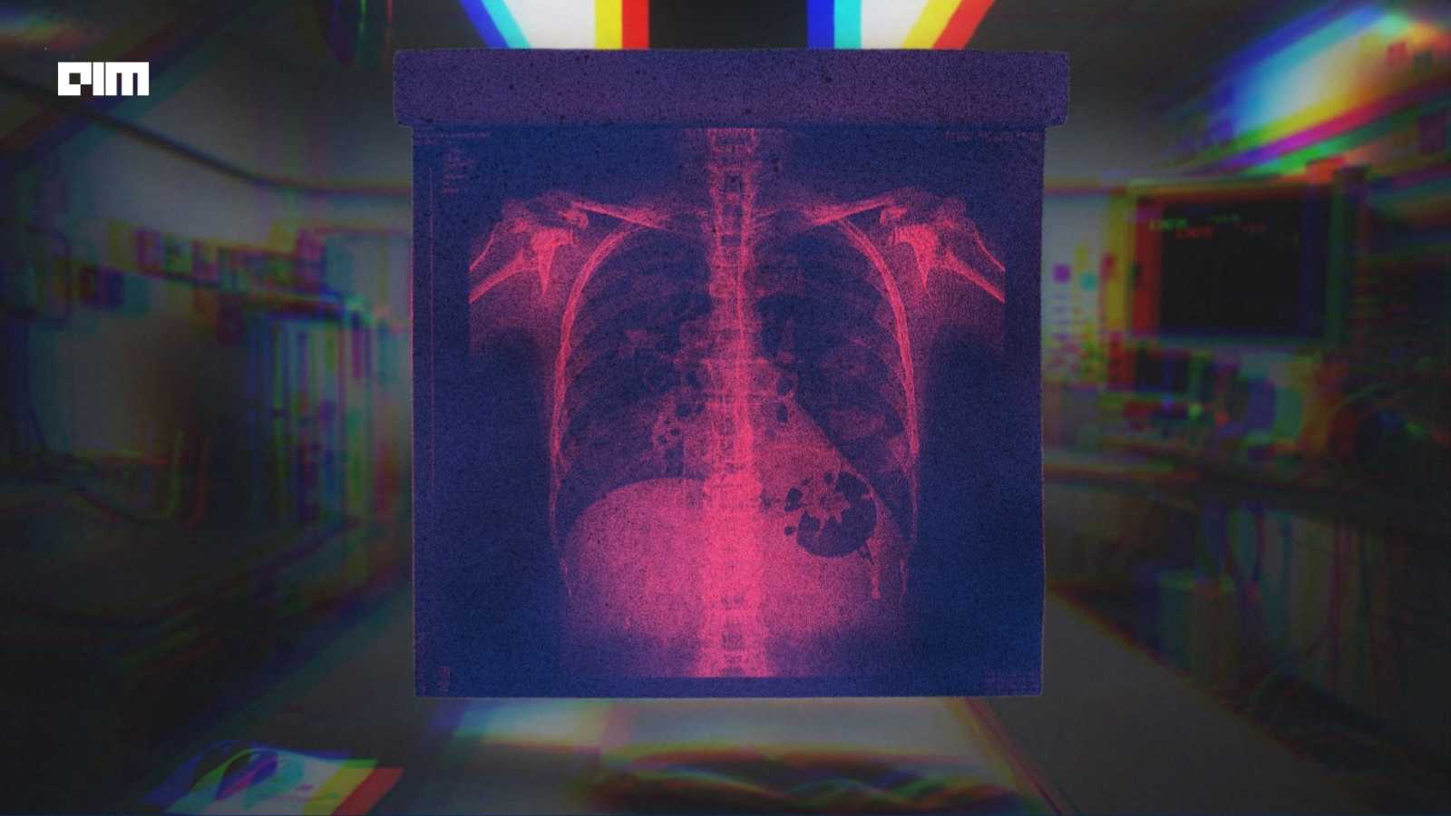 Big Money Is Buying Up Radiology AI. Here's Why