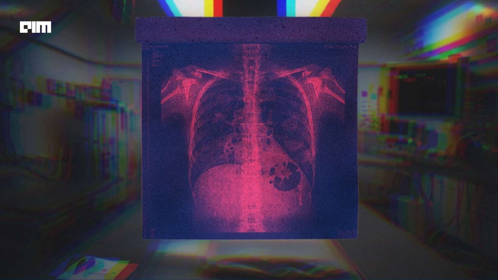 Memorial Sloan Kettering Partners Lumonus To Advance AI Radiation Planning