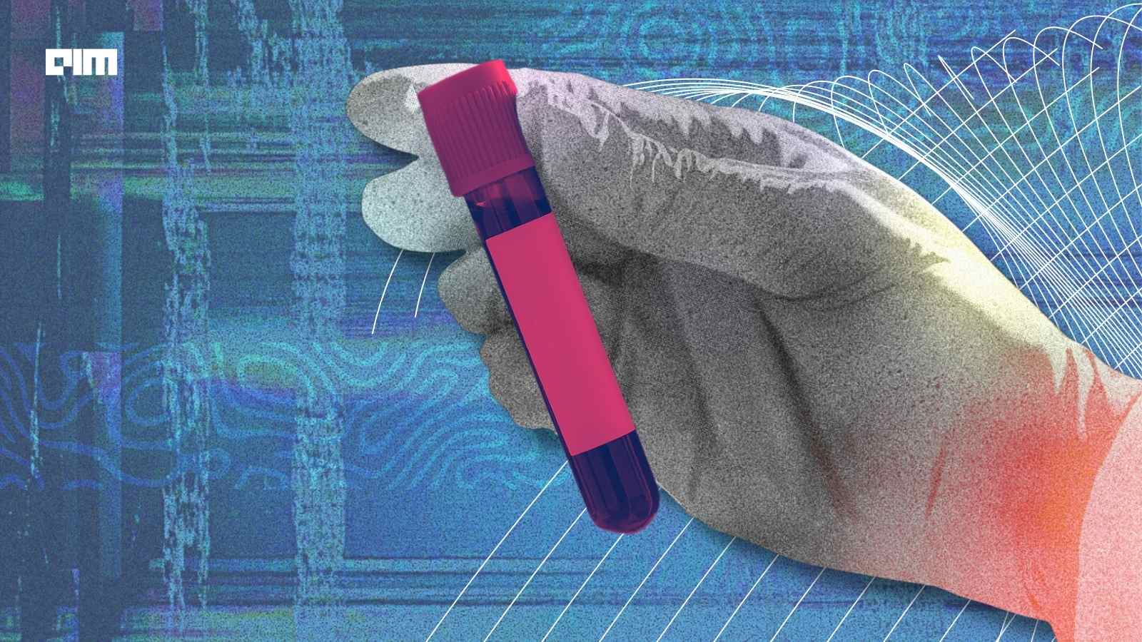 Quanterix and Tempus Integrate AI-Guided Alzheimer’s Blood Testing
