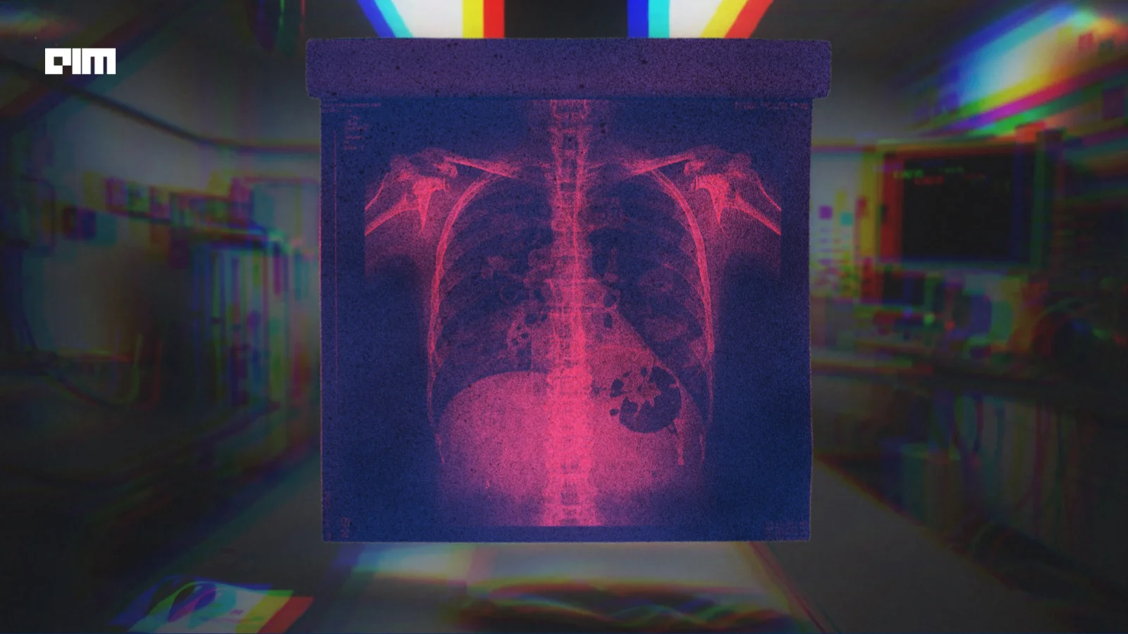 How is AI Transforming Radiology Reporting?