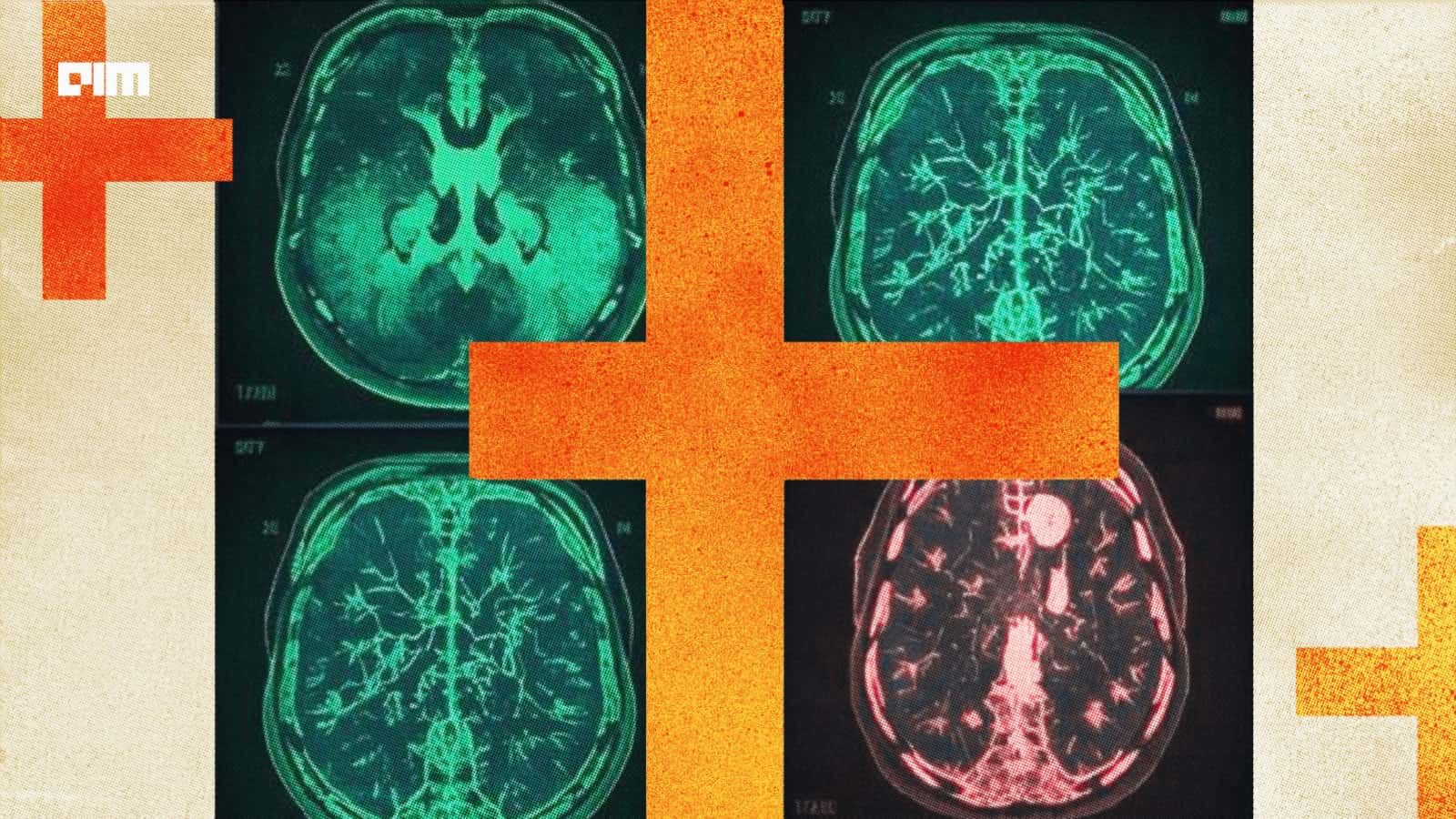 GE HealthCare Brings AI to Breast Imaging and Portable Ultrasound